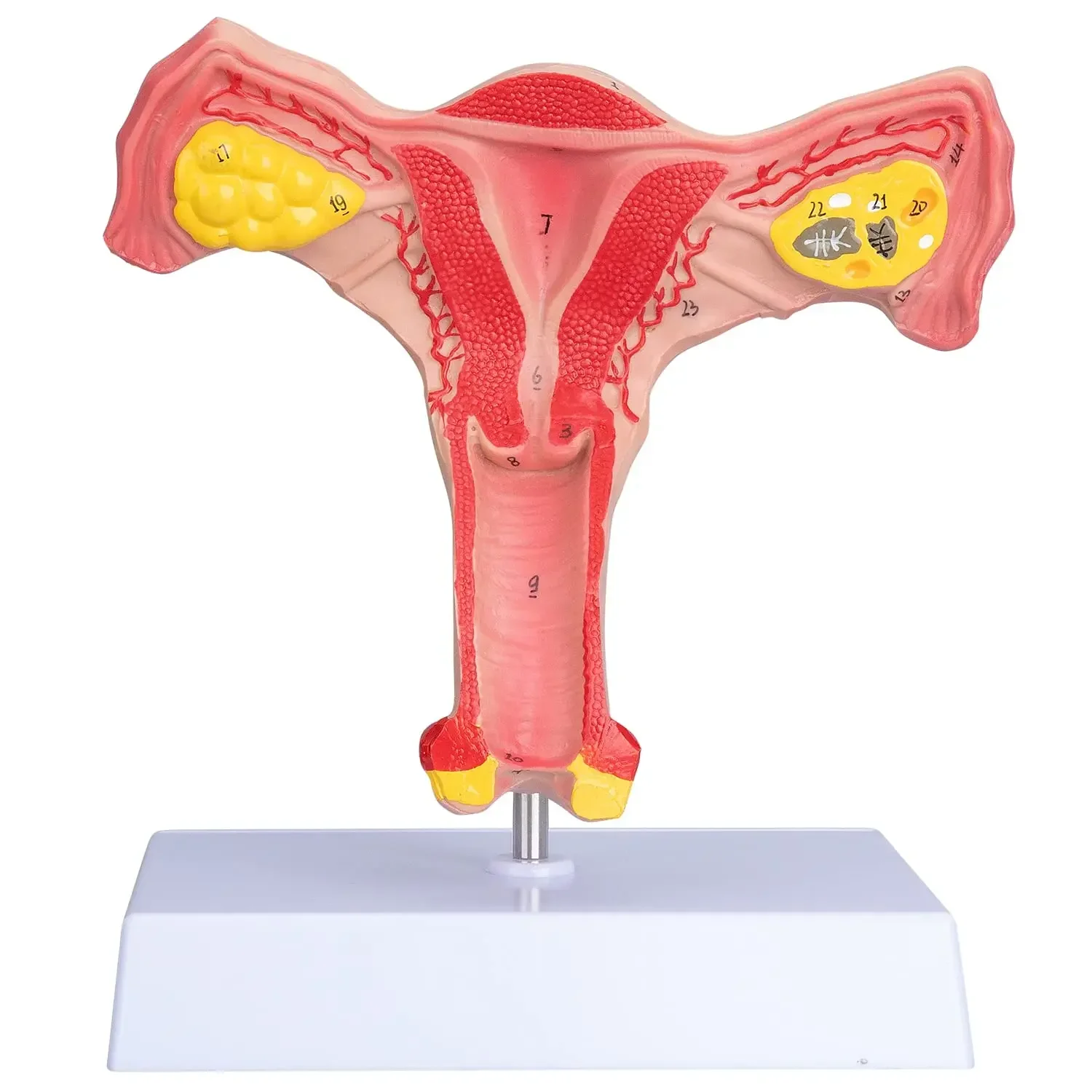 Human Uterus and Ovary Model Reproductive Organ Model Life Size Human Anatomy Model Teaching Tools