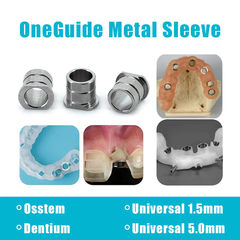 10Pcs Kit OneGuide Metal Sleeve Dental Surgical Guide Sleeve Grade 5 Titanium Sleeve for Osstem Dentium TS System Fast Shipping