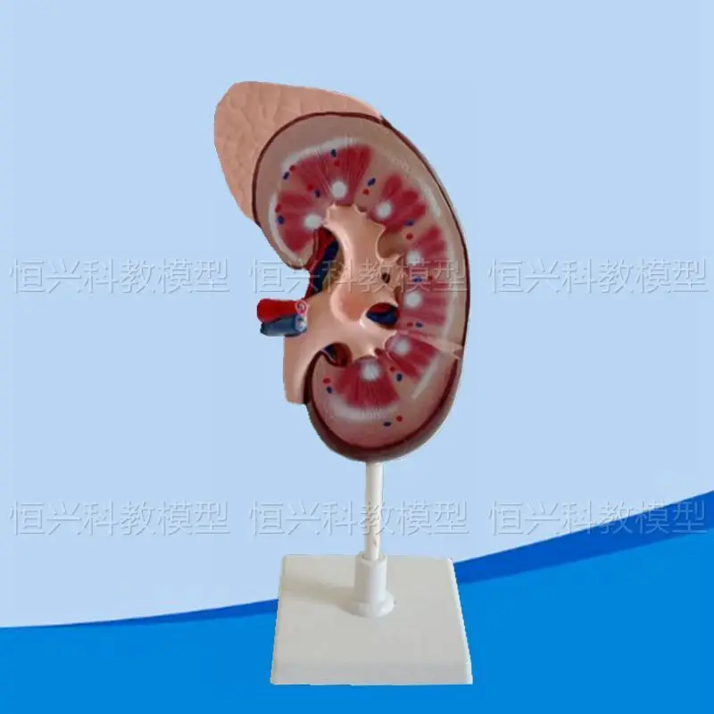 Renal model, adrenal artery and vein vascular teaching instrument, anatomical specimen for medical students