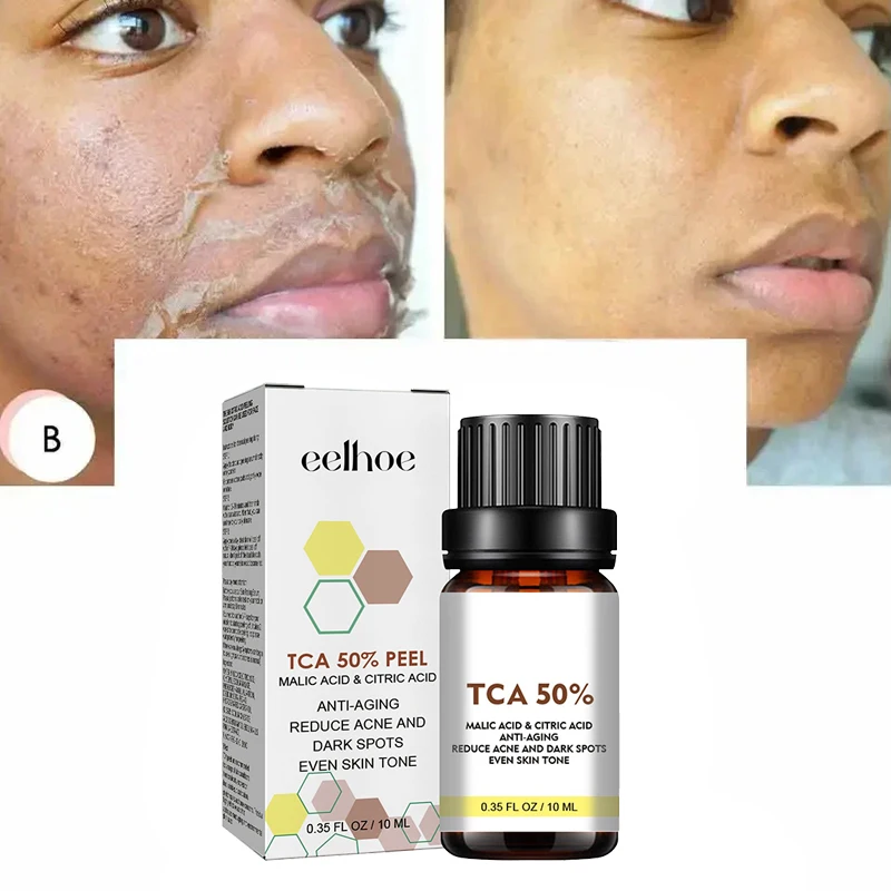 

NEW Salicylic Acid Facial Exfoliation Neutralizer Facial Deep Home Chemical Exfoliation Refining Skin Care essence