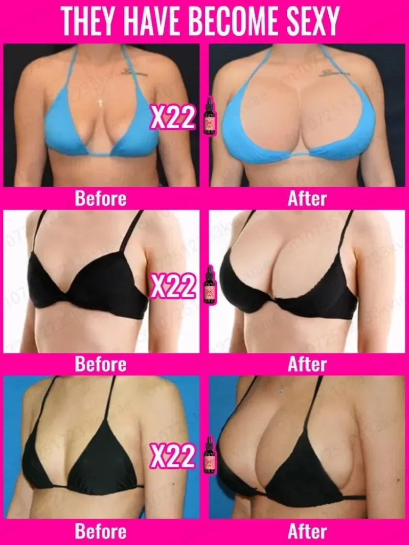 32 Pcs Breast Enlargement Patches Chest Enhancer Promote Female Hormone Lift Firming Breast Growth Plumping Massage Patch