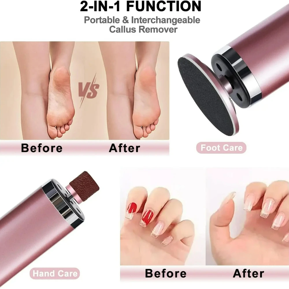 Electric Foot Callus Remover 2 In 1 Nail Foot File Pedicure Tool Rechargeable Wireless Powerful Foot Scrubber Dead Skin Remover