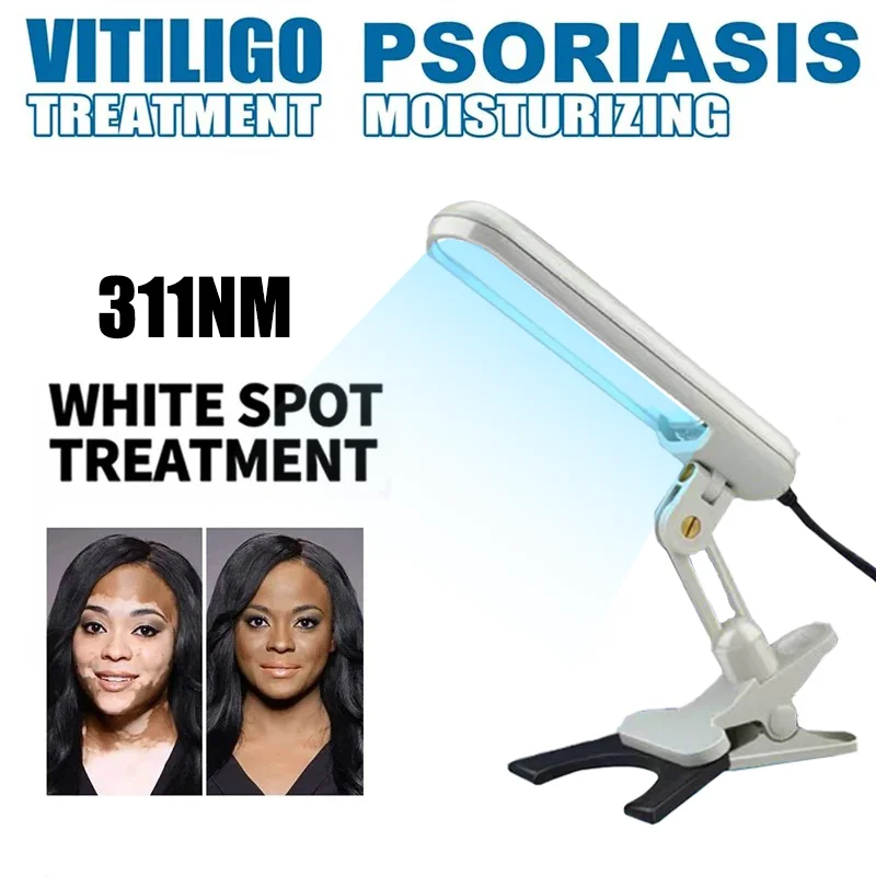 

UVB 311nm Lamp UV for Vitiligo Psoriasis White Spots Skin Disease 311nm Ultraviolet Phototherapy Instrument