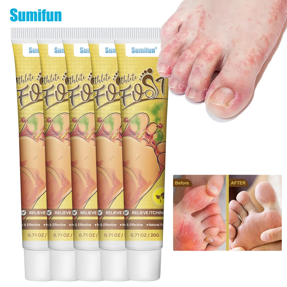 

1/3/5/10/20/30Pcs Treat Athlete's Foot Beriberi Anti Itching