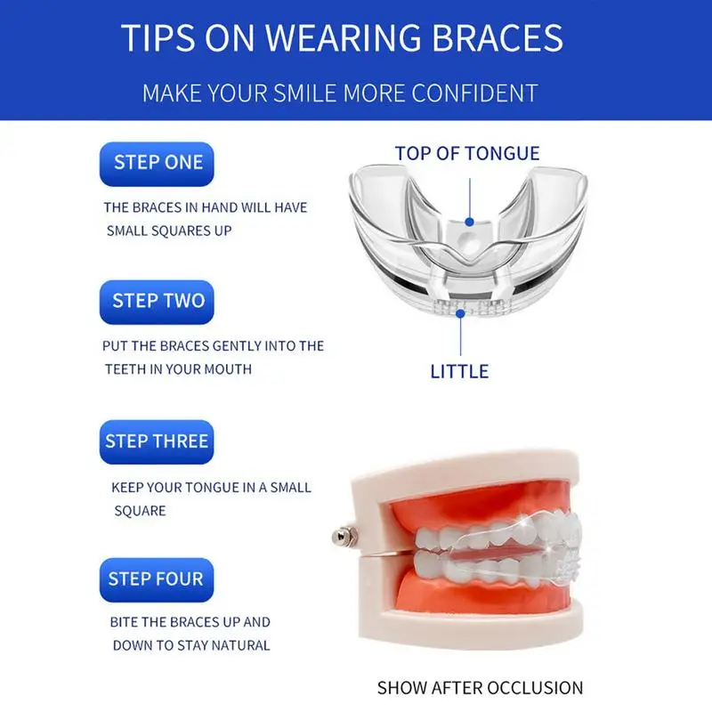 Tandorthodontische Beugels Volwassen Strapless Mondbeschermer Volwassen Tand Orthodontische Beugels Harde En Zachte Tanden Tand Aligners Trays