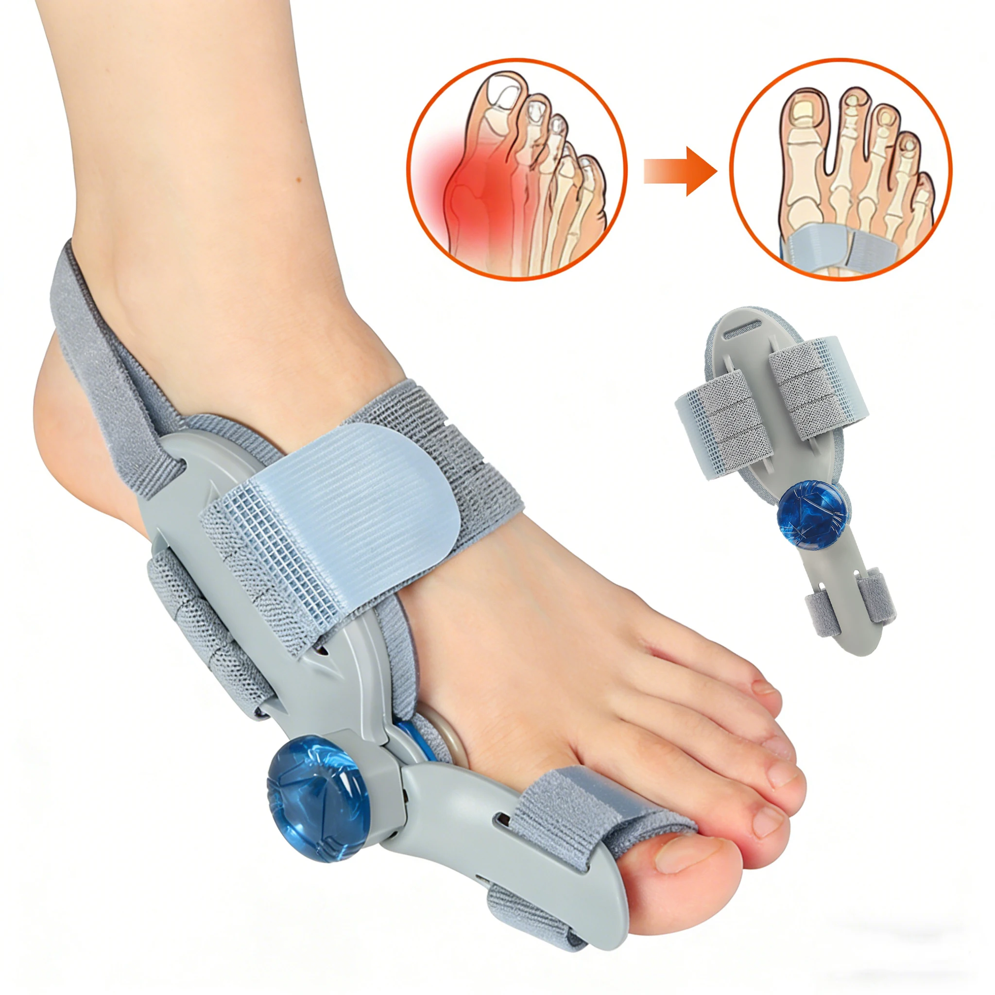 

Регулируемый корректор для пальцев ног с углом наклона 180 градусов ° Корректор для пальцев ног при вальгусной деформации стопы, инструмент для педикюра и ухода за ногами, унисекс