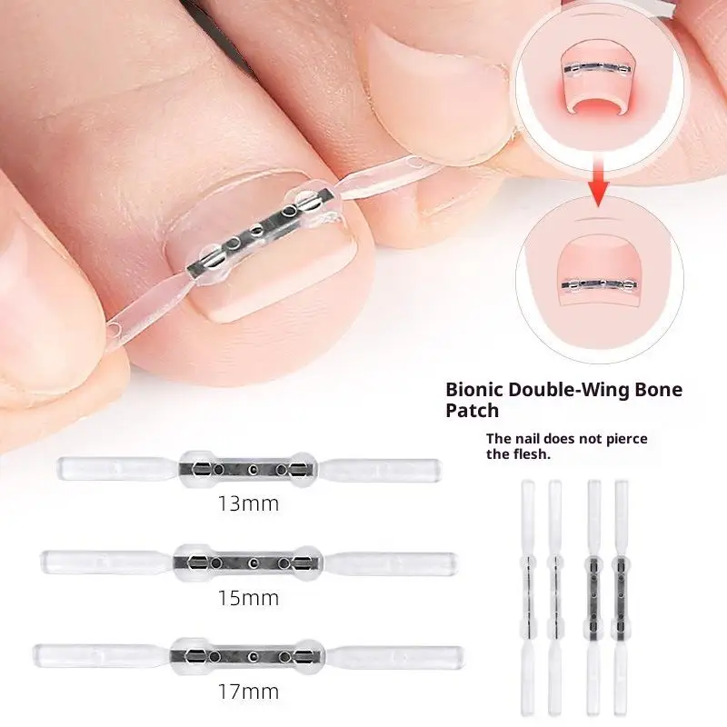 Corrector de uñas encarnadas, herramientas para pedicura, recuperación integrada, tratamiento de uñas de los pies, soporte profesional para alisar uñas encarnadas