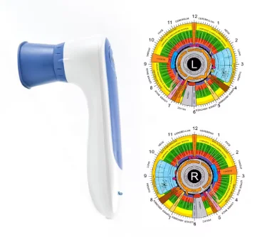 

usb digital scan iris analysis machine iridology recording eye