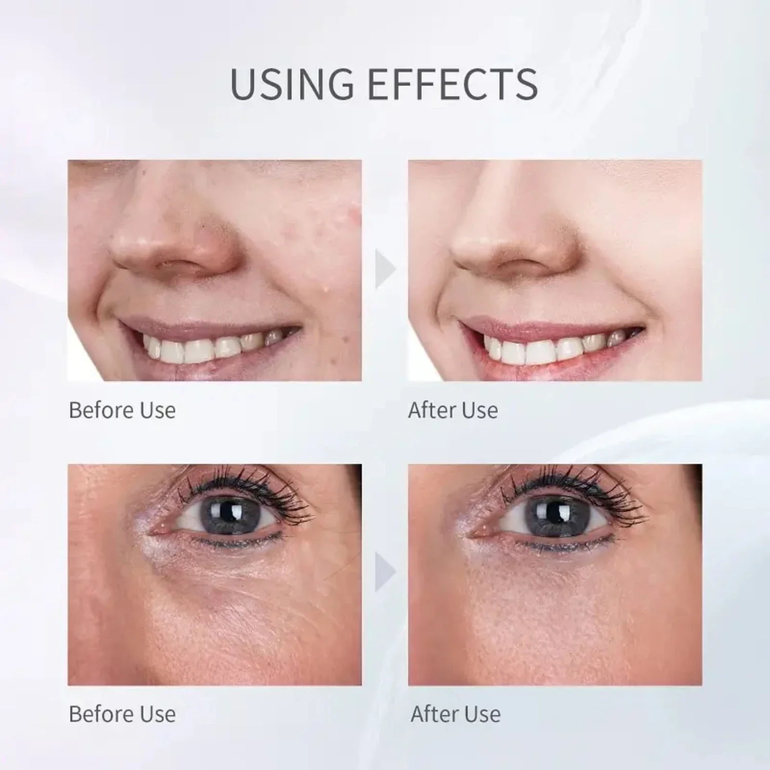 Advanced Ultrasonic Electric Facial Skin Scrubber for Deep Cleansing and Exfoliation at Home - Rejuvenate Your Skin with this Ul