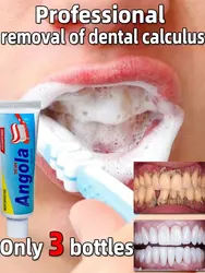 Remover Dental Calculus Toothpaste Remove Yellow Teeth Bad Breath Cleaning Plague ToothStain Whitening Preventing Periodontitis