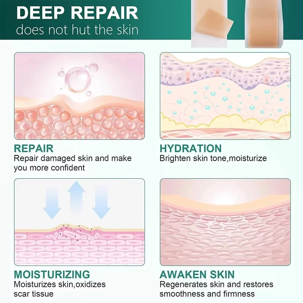 4X10/50/150 سنتيمتر سيليكون ندبة ورقة هلام السيليكون ورقة الجمال التصحيح الجلد رقعة إصلاح الإطارات المحمولة كفاءة الجمال ندبة إزالة الشريط