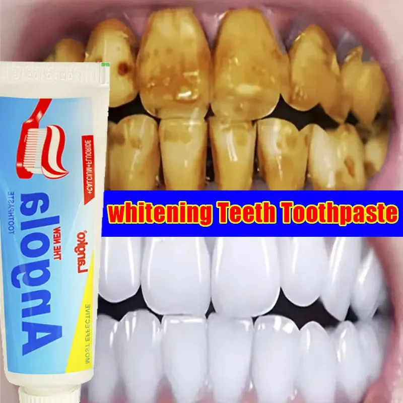 

Remove calculus Whiten teeth Remove oral odor Prevent periodontitis