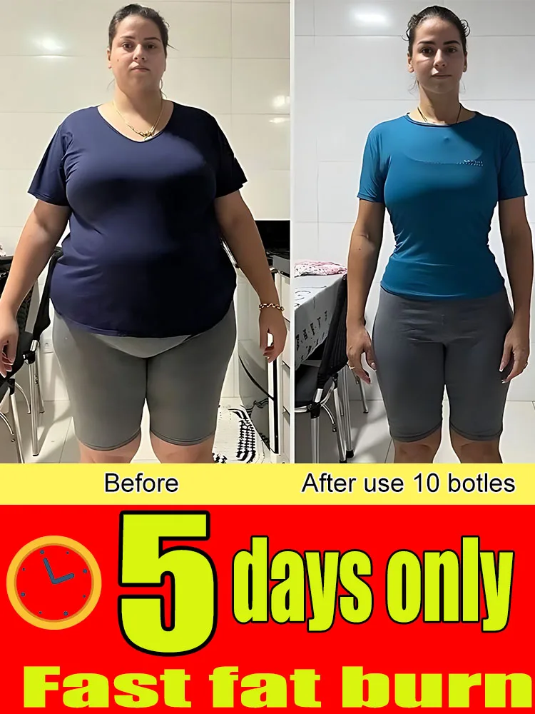 2024 New Weight Loss Essential Oil Products for Slimming Belly That Fast Down Rare Beauty