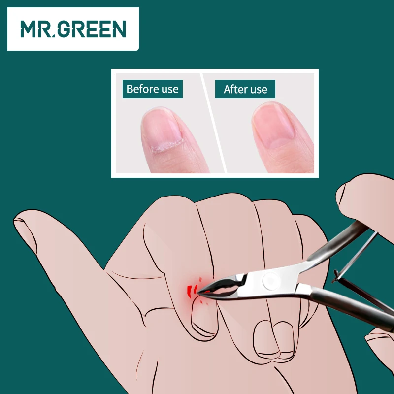 MR.GREEN Pinzas para cutículas Manicura de uñas Tijeras para cutículas Clippers Recortador Removedor de piel muerta Pedicura Herramienta de