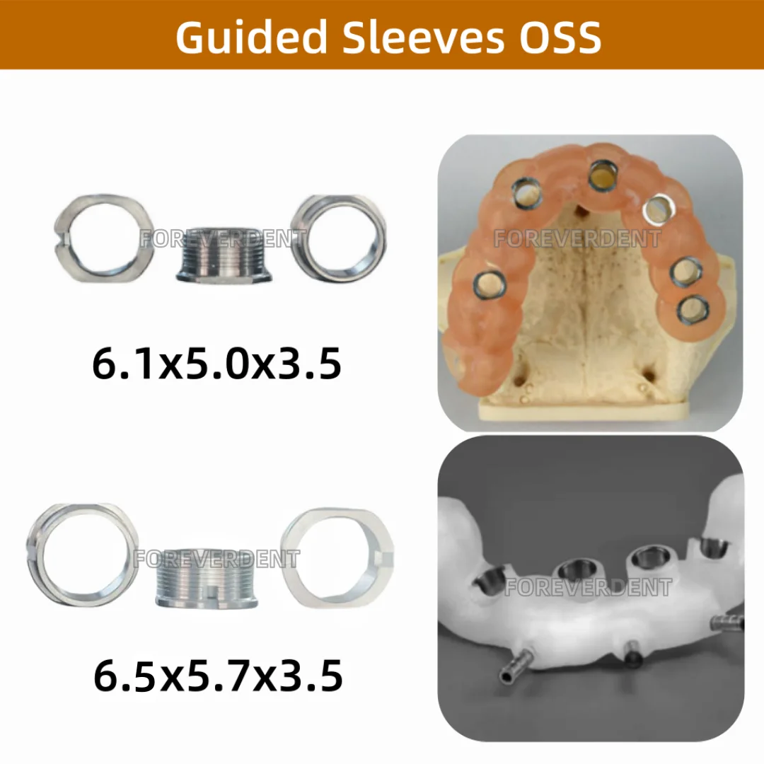 10pcs Dental Digital OSS Guided Sleeves Digital Implant Planning Template Drill Position ∅5.0/5.7mm