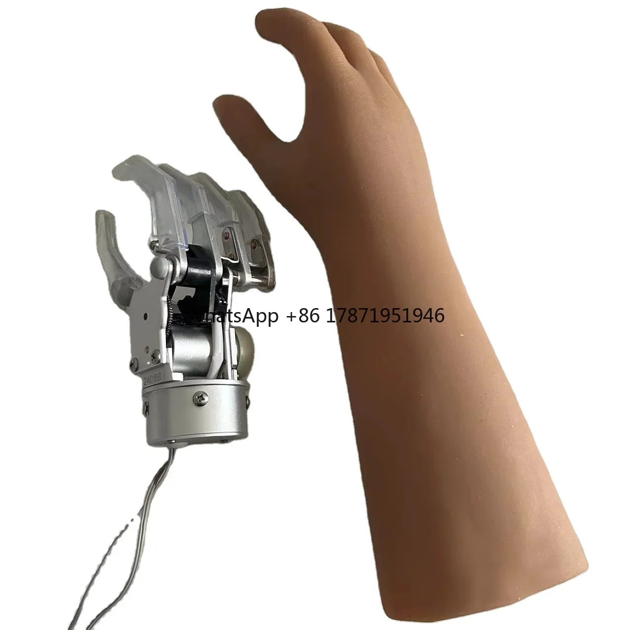 Prosthetic Myoelectricity Control Prosthetic Hand With One Degree Of Freedom For Adult