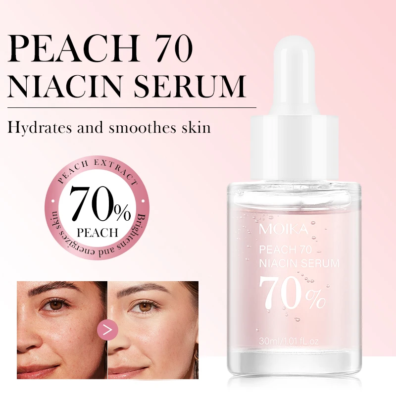 

MOIKA Skincare Peach 70 Niacin Serum 70% Moisturizing 30ml Dark Spot Fade Marks Hyperpigmentation Shrink Pores Even Skin Tone