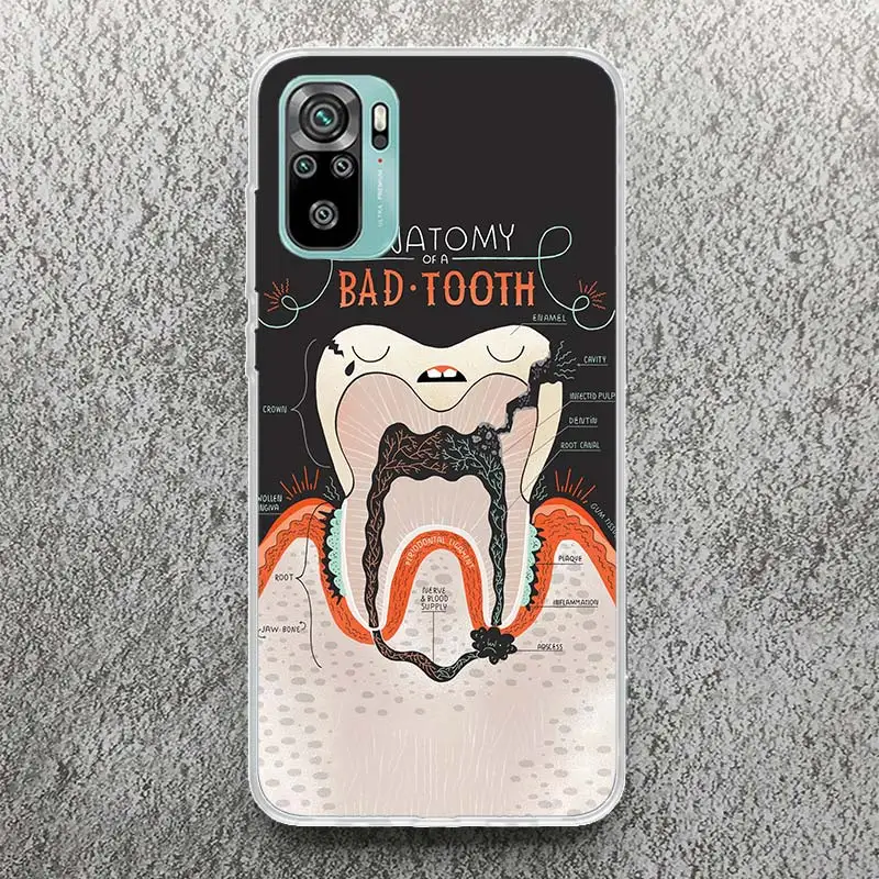 Wisdom Teeth Dentist Tooth Print Soft Case for Xiaomi Redmi Note 12S 11S 12 11T 10S Phone Shell 9S 8T 11 10 9 8 11E Pro Plus 7 C