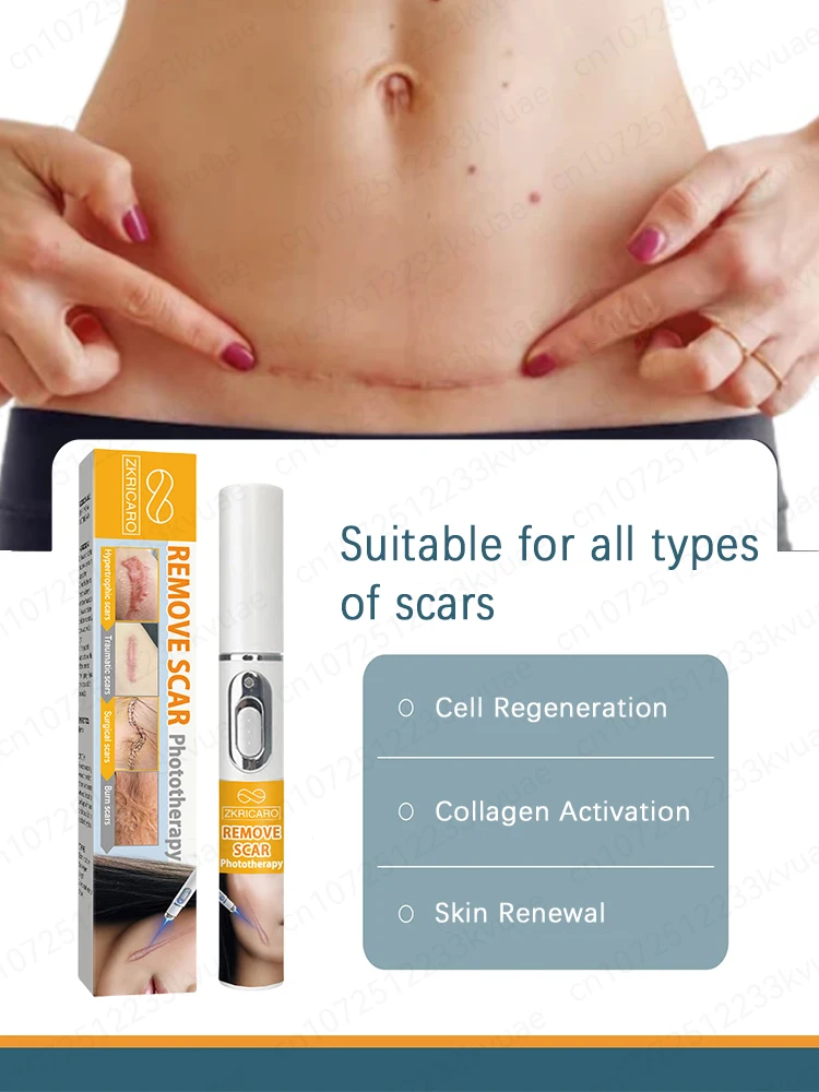 Laserlittekenverwijdering, geschikt voor alle soorten littekens, veilige en gezonde littekenverwijdering