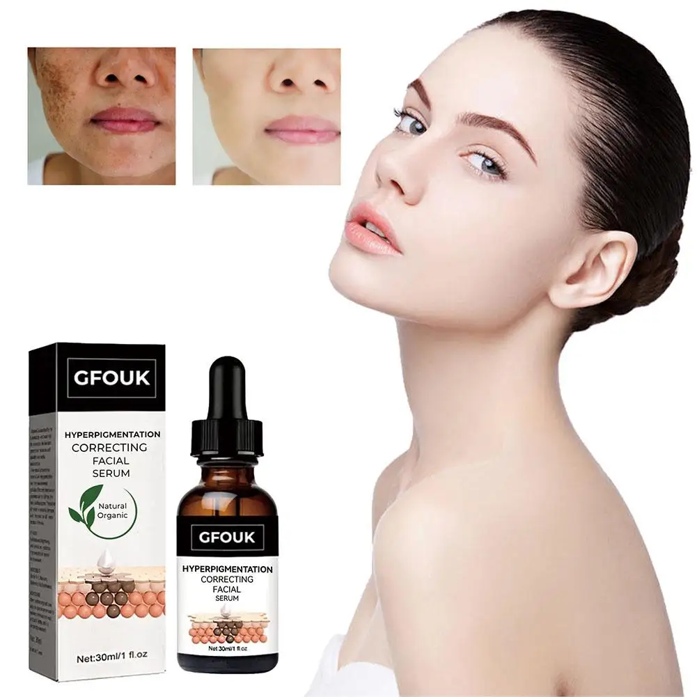 Serum Wajah pengoreksi GFOUK, korektor noda gelap, Serum Wajah untuk kulit cerah 30ml