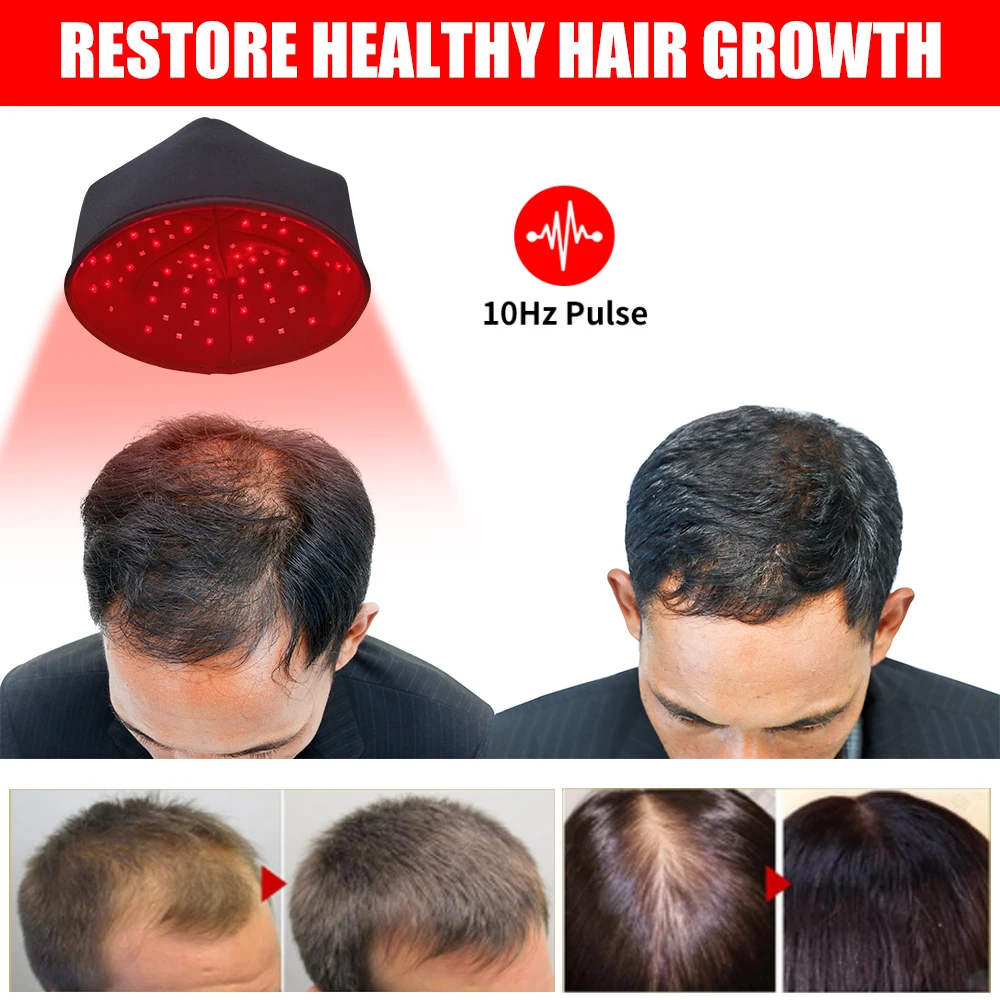 

Кепка для восстановления волос красного света, светодиодная шапка для ухода за волосами, 660 нм, 830 нм, инфракрасный свет, шапка для ухода за кожей головы для домашнего использования