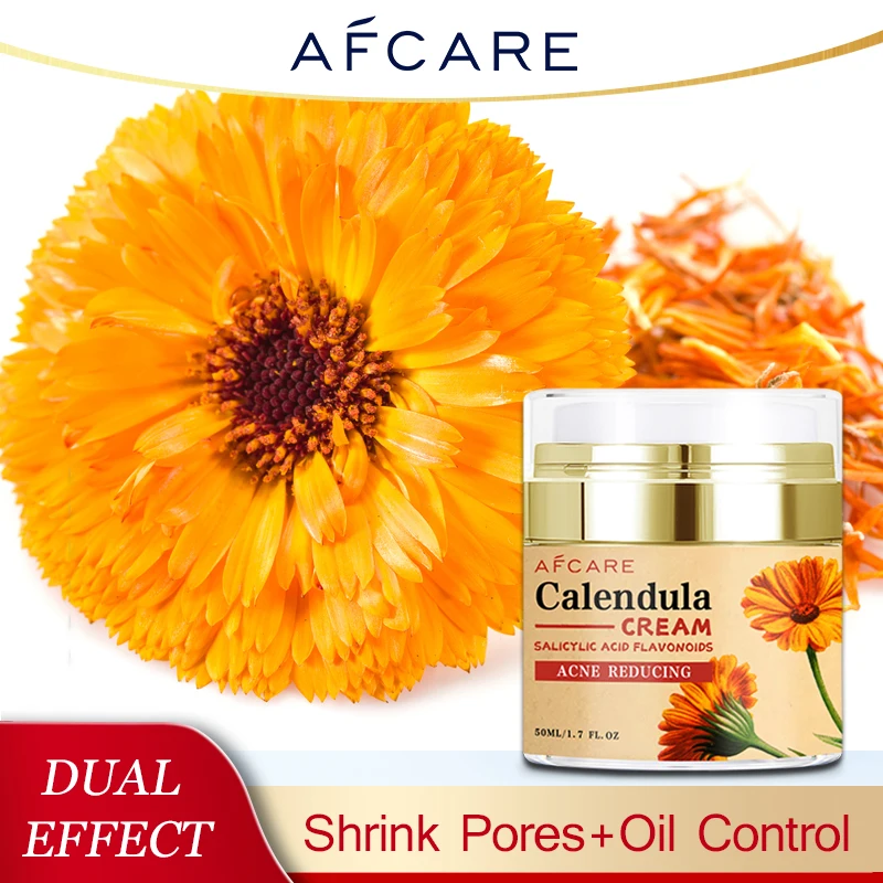 Calendula Herbal Extract Cream For Normal To Oily Skin Reduces Redness Oil Control Skin Care Naturally Heal Skin Irritations