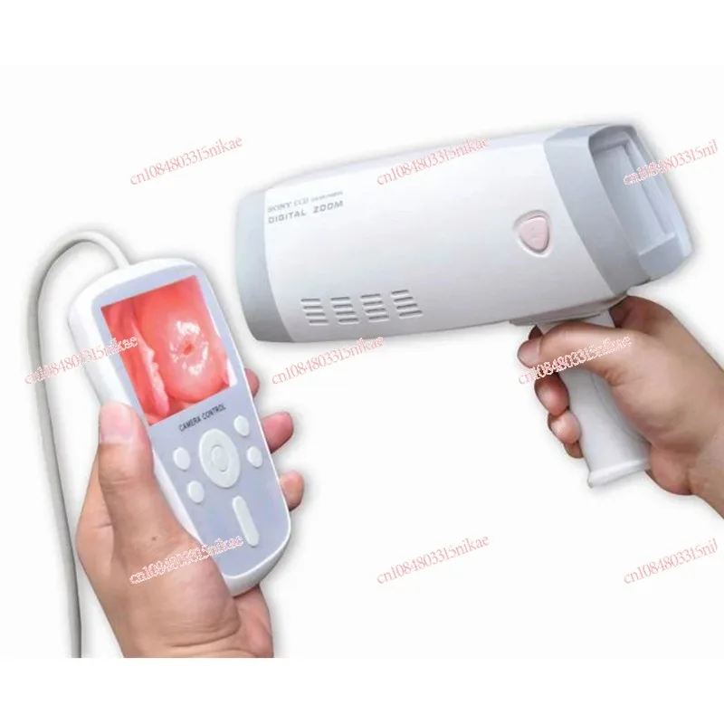 Handheld Digital Video Colposcope for Gynaecology Analysis MSLCE04