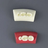 Modelo de llenado Oral, modelo de ejercicio con incrustaciones dentales, bloque de ejercicio de relleno, materiales de resina Typodont para enseñanza de odontología, 1 Uds.