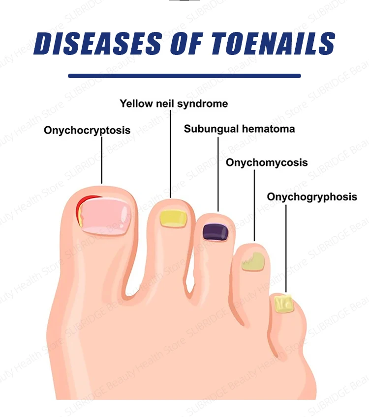 

Solving the nail problem