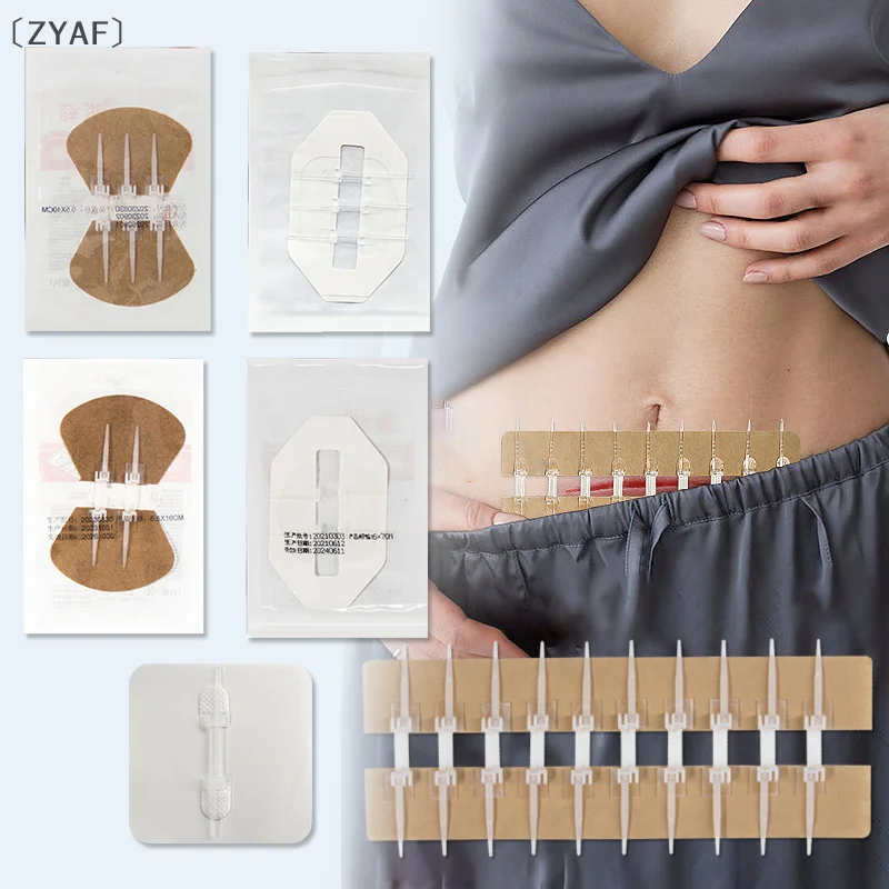 

〔ZYAF〕Emergency Wound Closure Zip Stitch Sutures Bandaids Repair Wounds Without Stitches For Outdoor Activities Quick Clot Wound