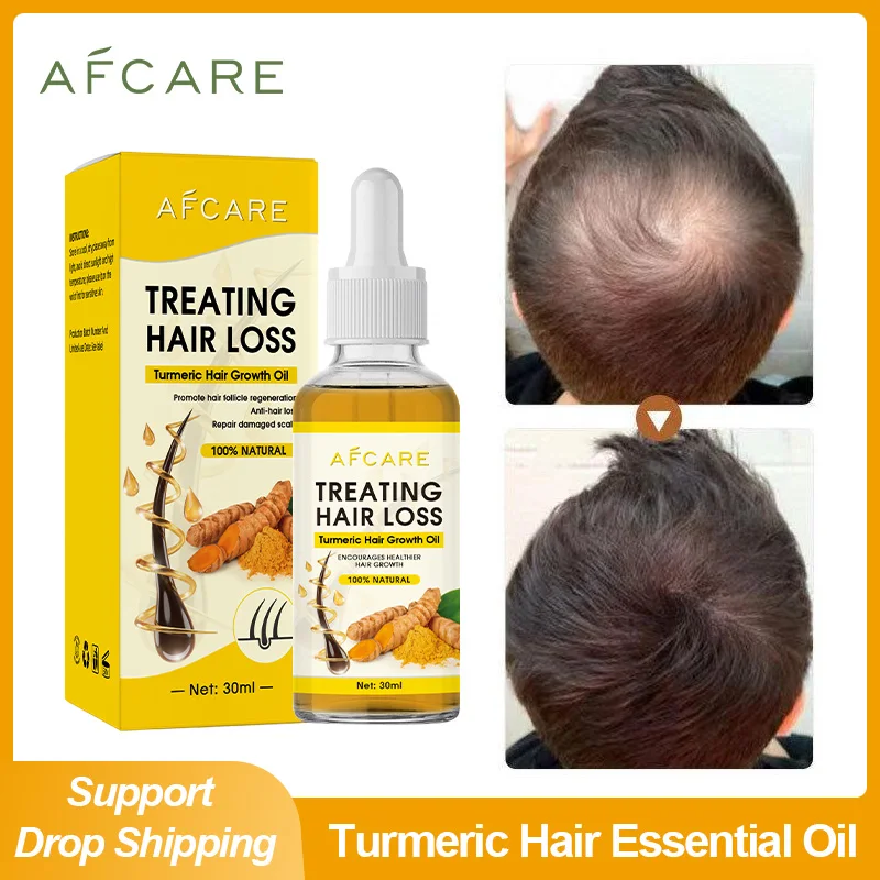 Afcare Turmeric Hair Growth Ginger Essential Oil Treat Hair Loss Scalp Repair Nourish Hair Roots Regrowth Beauty Health Products