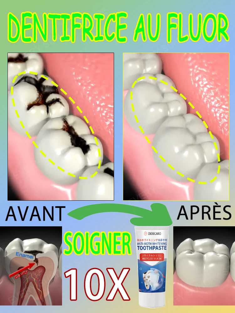 tooth decay