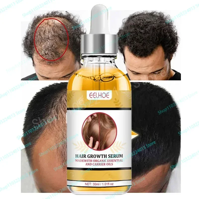 

Sdottor Fast Hair Growth for Men Women Hair Oil Care Ginger Anti Hair Loss Scalp Treatment Grow Serum Products Beauty Health