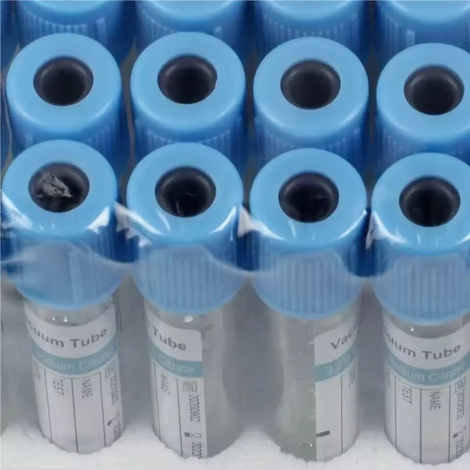100本入り 1ml 5ml 使い捨て真空採血管 PTチュー - Blood Collection Tube のレビューと価格