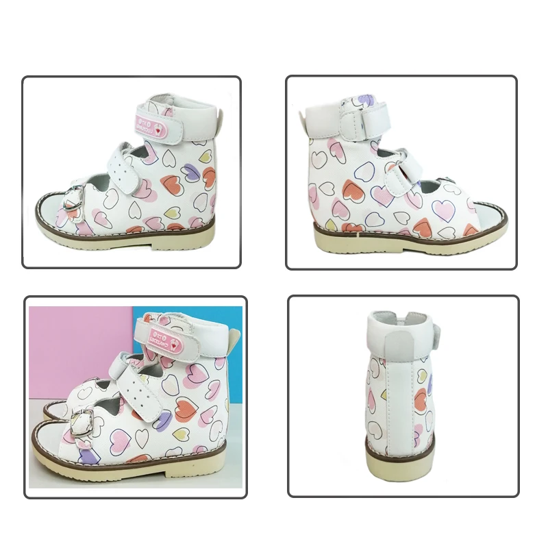 Zomermeisjes Orthopedische Schoenen Voor Kindermode Schattige Sandalen Platte Voeten Schoeisel Met Steunboog Size22-32