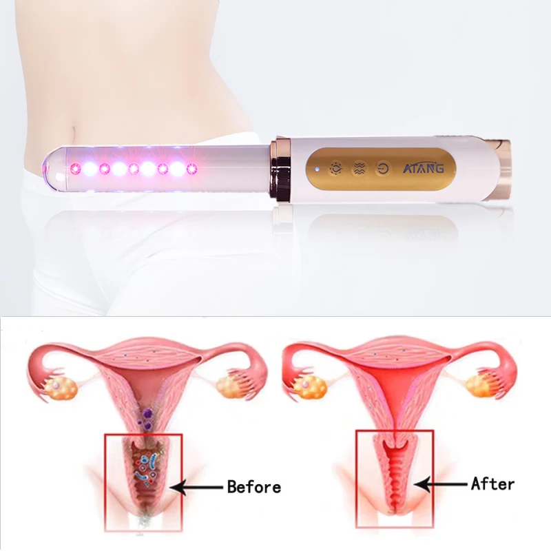 Massage Relaxation Vaginal Uterine fibroid pain Laser Therapitic Vaginal Tightening bacterial Pelvic inflammatory