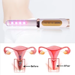 Virgin Infection Rehabilitation Equipment Cold Laser Vaginal Tighten Wand Women Health Care Erosion Treatment Home Use