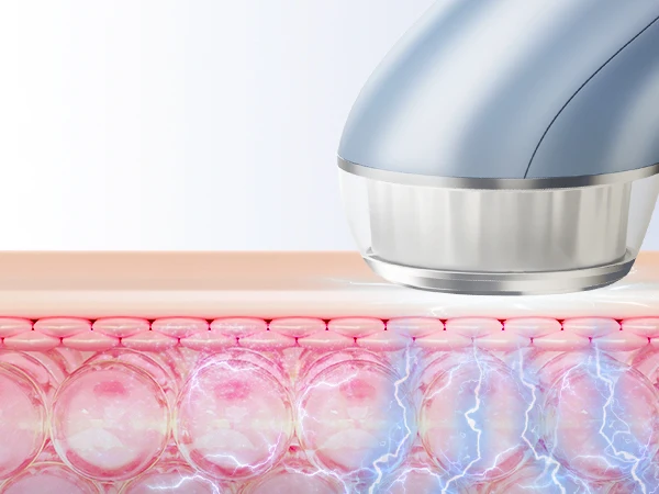 Wrinkle remover