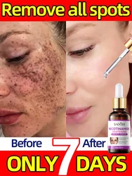 Whitening Freckles Serum Cream Remove Dark Spots Melasma Niacinamide Lighten Melanin Anti-aging Moisturizing Brighten Skin Care