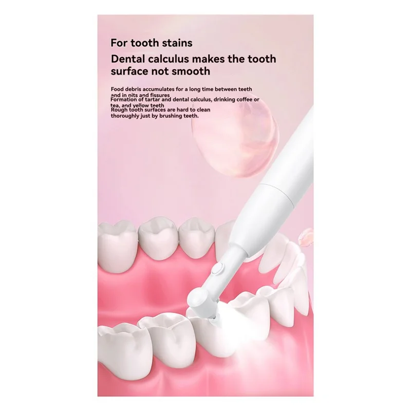 A74G-電気超音波歯石クリーナー歯のホワイトニング歯石エリミネーター歯石プラーク歯ポリッシャー