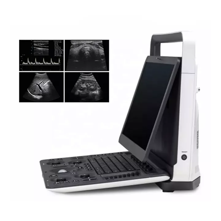 Vet ultrasound device portable buy a ultrasound  portable Sheep ultrasound scanner