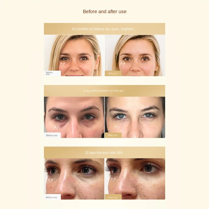 قناع العين، رقعة العين الكهربائية تقلل من التجاعيد والانتفاخ والهالات السوداء، جهاز تدليك العين #3