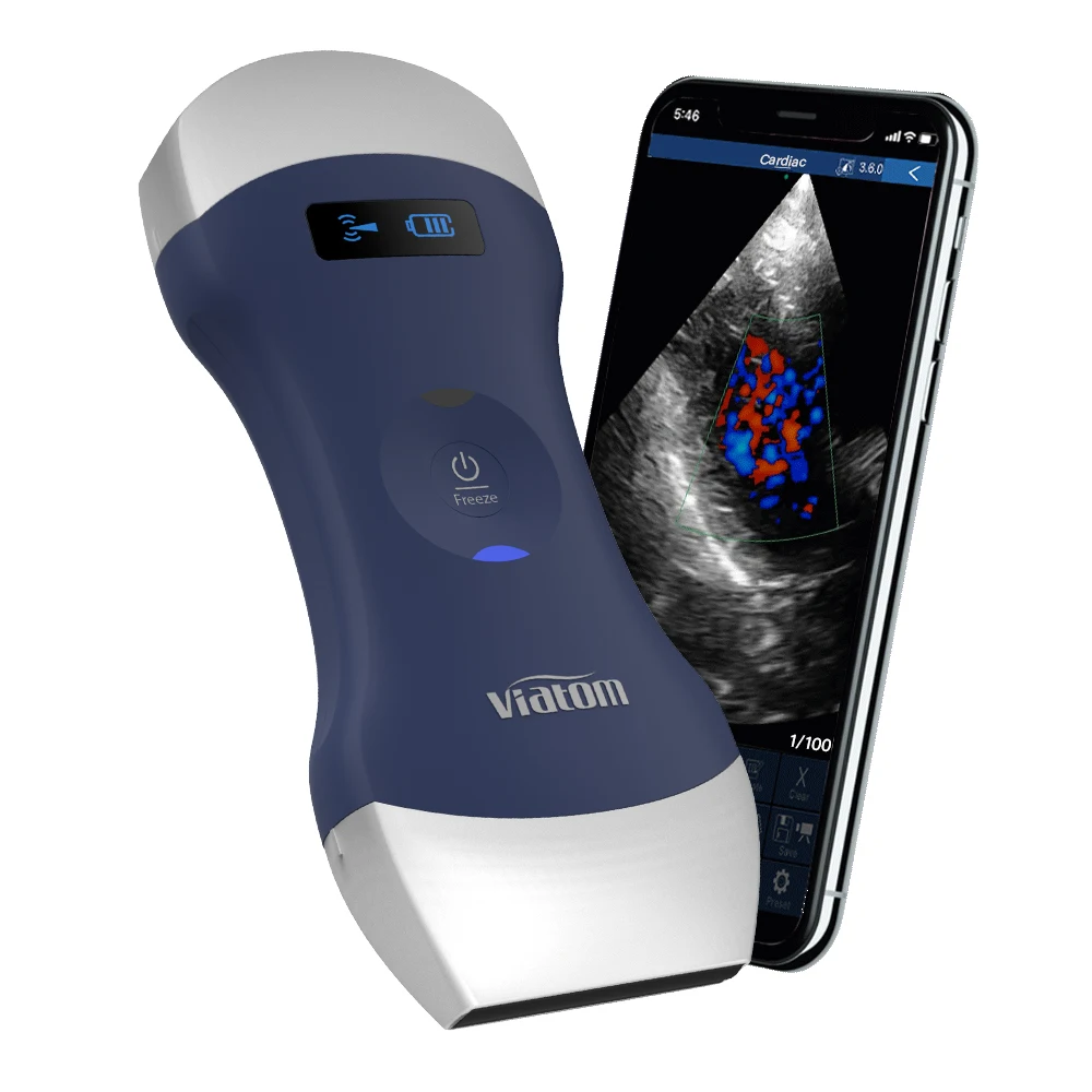 Viatom Professional Ultrasound Scanner Portable Doppler Full-body Diagnostic Imaging Solution WIFI Handheld Convex /Linear Probe