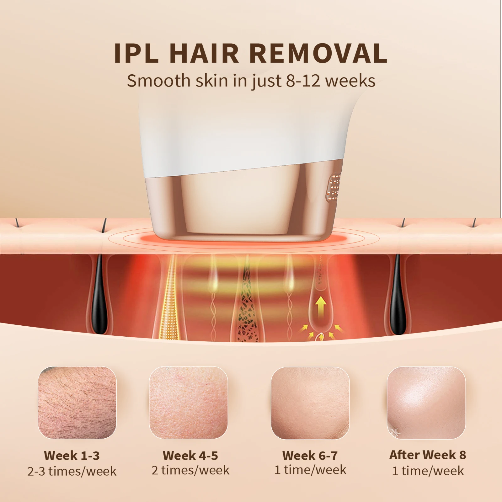 Thumbnail 4 - #23 Ranked Hair Removal Devices Picks in 2026