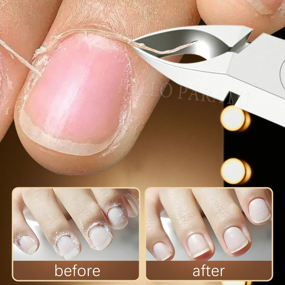 1Pcs Professionelle Nagelhautzange Edelstahl Scharfe Klingen Nagel Häutchen Clippers Cutter Trimmer Maniküre Werkzeug