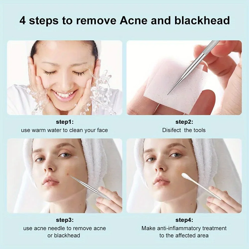 Puistje Extractor Gereedschap, Mee-eter Remover, Puistje Popper, Acne Verwijdering Kit Risicovrije Behandeling, Whitehead Popping, Mee-eter Pincet