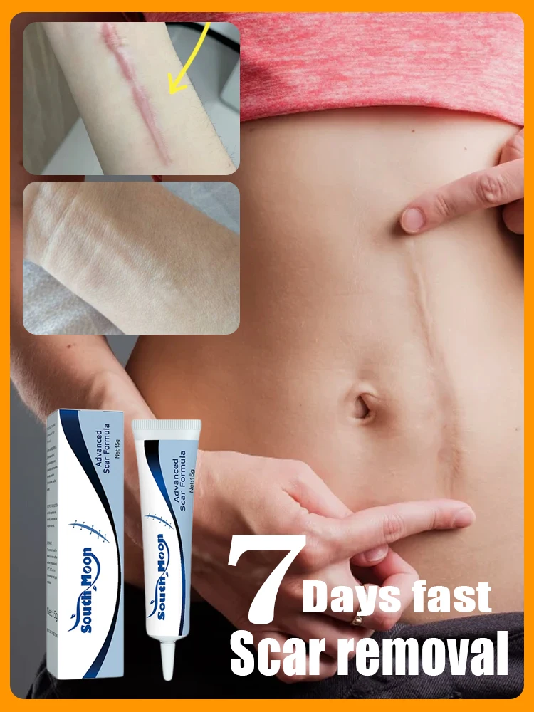 

Remove various scars, stretch marks, surgical scars