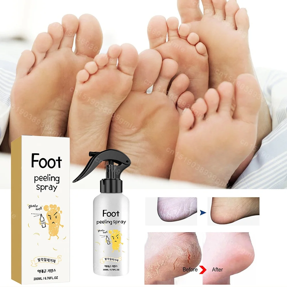 Foot Exfoliating Repair Brightening Spray Anti-Drying Crack Peeling Treatment Removal Dead Skin Calluses Feet Nursing Tools