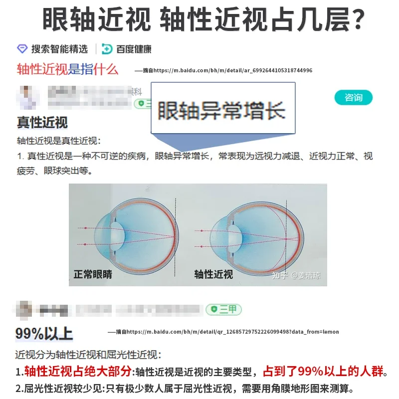 

Children's eye protector