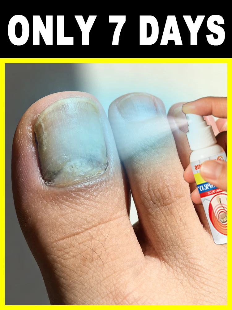 

Intervene early to maintain foot health ᵃⁿᵈ ˢᵃʸ ᵍᵒᵒᵈᵇʸᵉ ᵗᵒ ʳᵉᶜᵘʳʳⁱⁿᵍ ᵗʳᵒᵘᵇˡᵉˢ